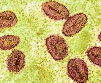 Nova pandemia? OMS declara mpox como emergência em saúde pública global