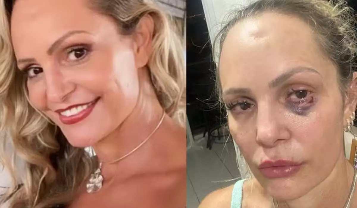 Personal trainer denuncia ex-companheiro policial por agressão em Cuiabá