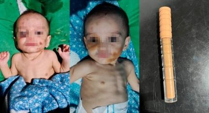Mãe é presa por deixar crianças sujas, sem comida e cobrir marcas de violência com maquiagem