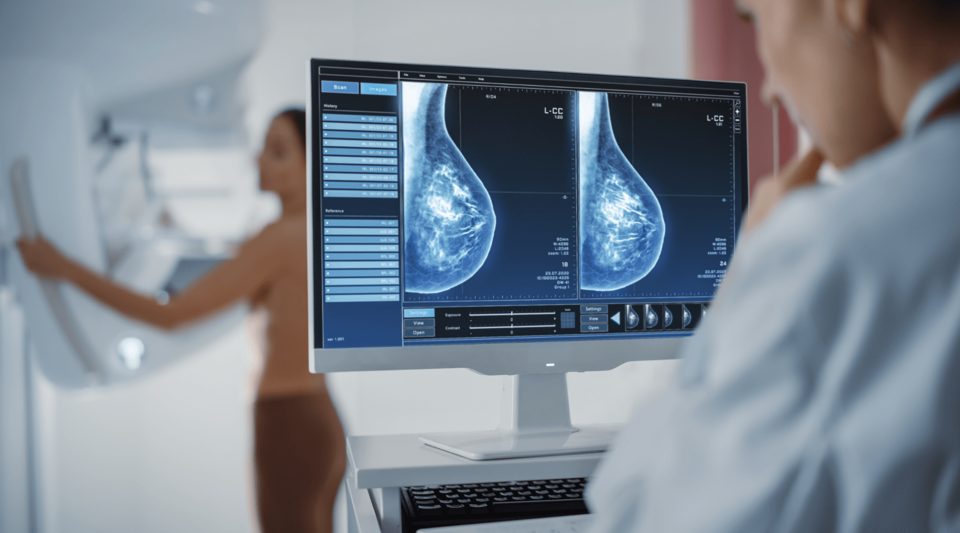 Outubro Rosa: Ascomcer oferece 400 mamografias gratuitas em Juiz de Fora
