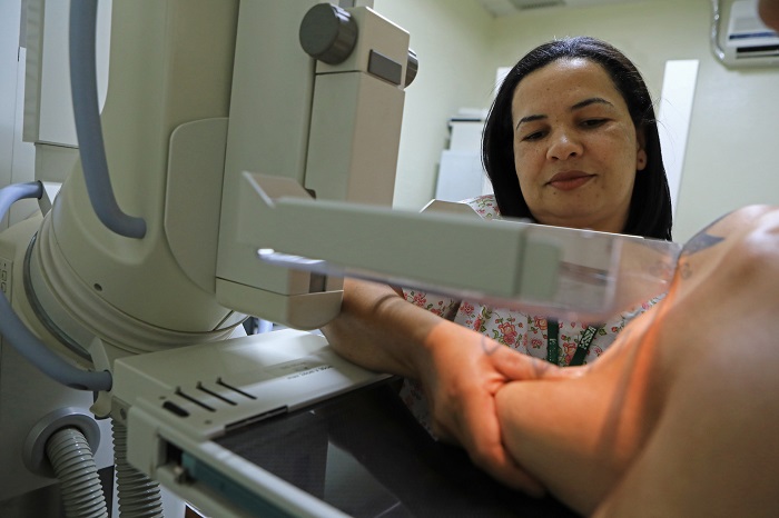 Mamografia: mitos e verdades sobre exame que diagnostica o câncer de mama